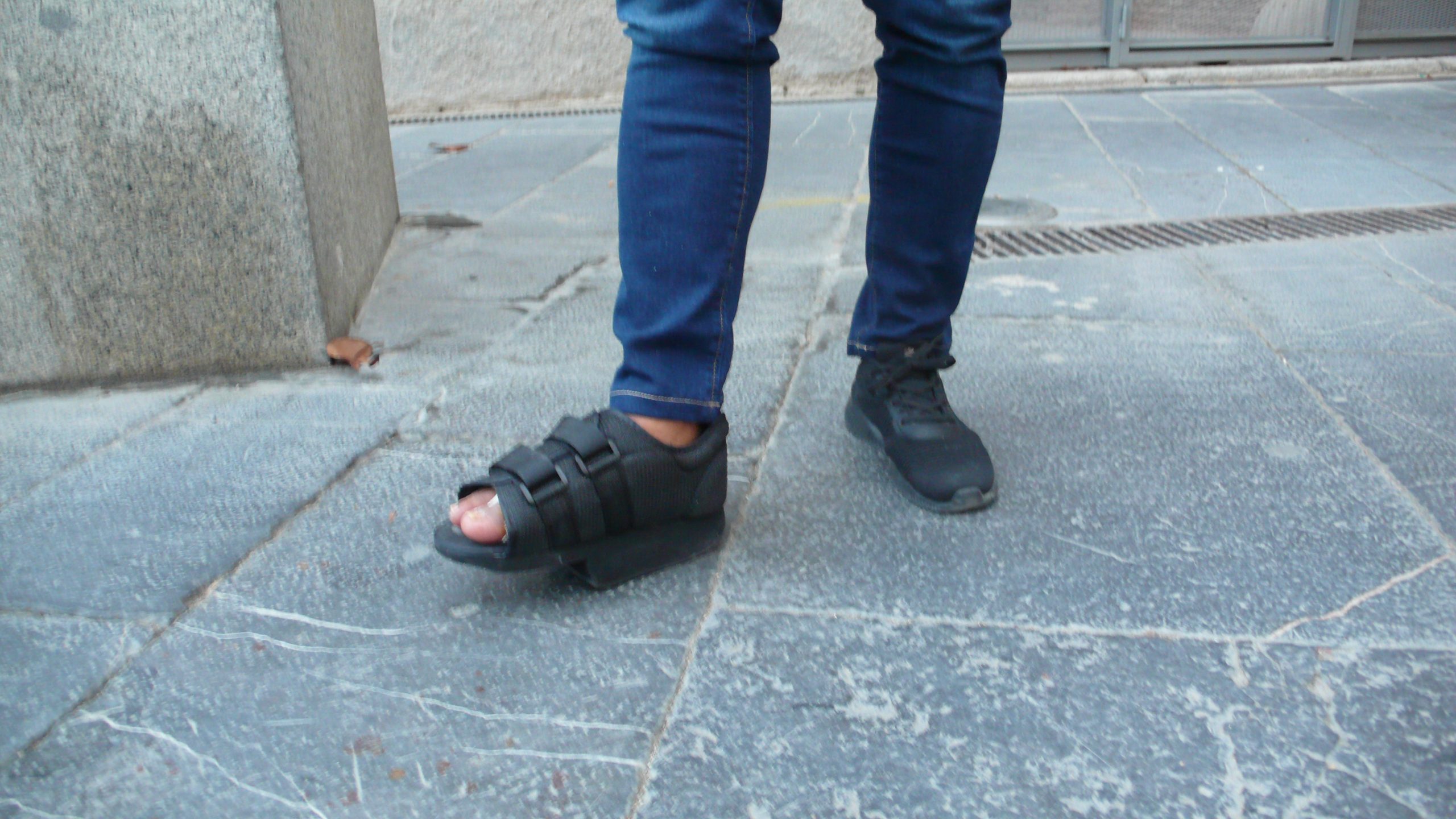 foto de los pies de una persona accidentada con un pie inmobilizado